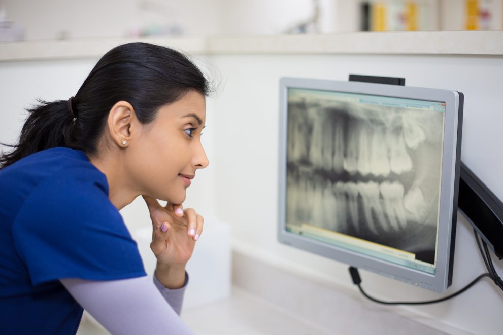 Closeup portrait of a dental health professional in blue scrubs examining dental x-ray on computer screen, isolated dentist office